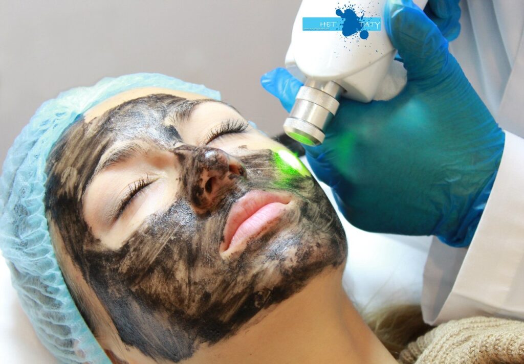 Laser carbon peeling at the Grail salon