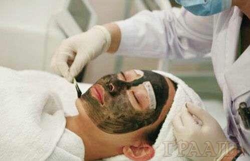 Carbon laser peeling