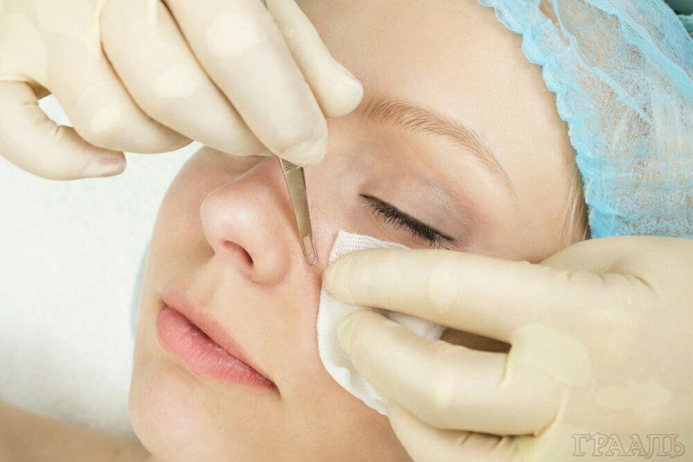 Mechanical facial cleansing at the Grail salon