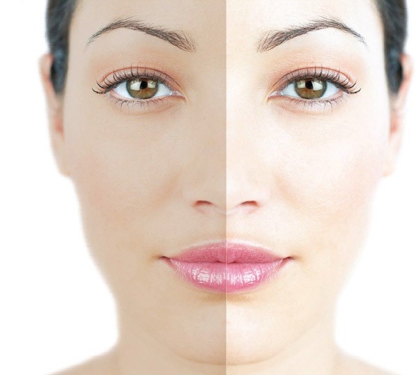 Освітлення шкіри обличчя в салоні Грааль